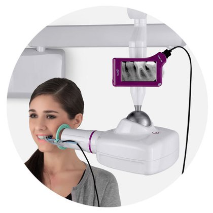 סנסור דיגיטלי אלחוטי X-Pod | X-Pod Portable Dental Scanner