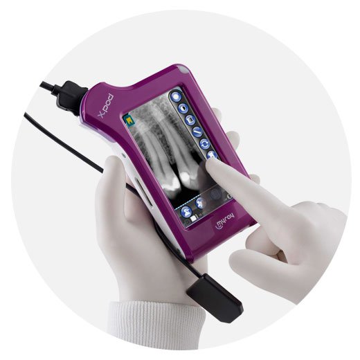 סנסור דיגיטלי אלחוטי X-Pod | X-Pod Portable Dental Scanner
